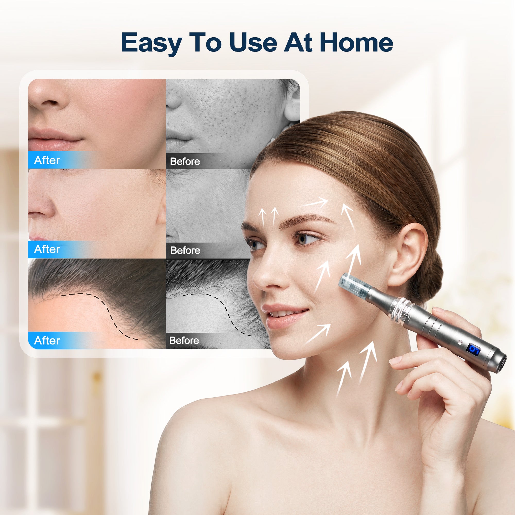 Microneedle Derma Roller Pen for Home Use - Microneedle Skin Care Tool for Men Women Home Use M8