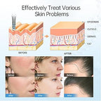 Dr. Pen M8 Ultima Pro Microneedling Pen