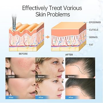 Dr. Pen M8 Ultima Pro Microneedling Pen