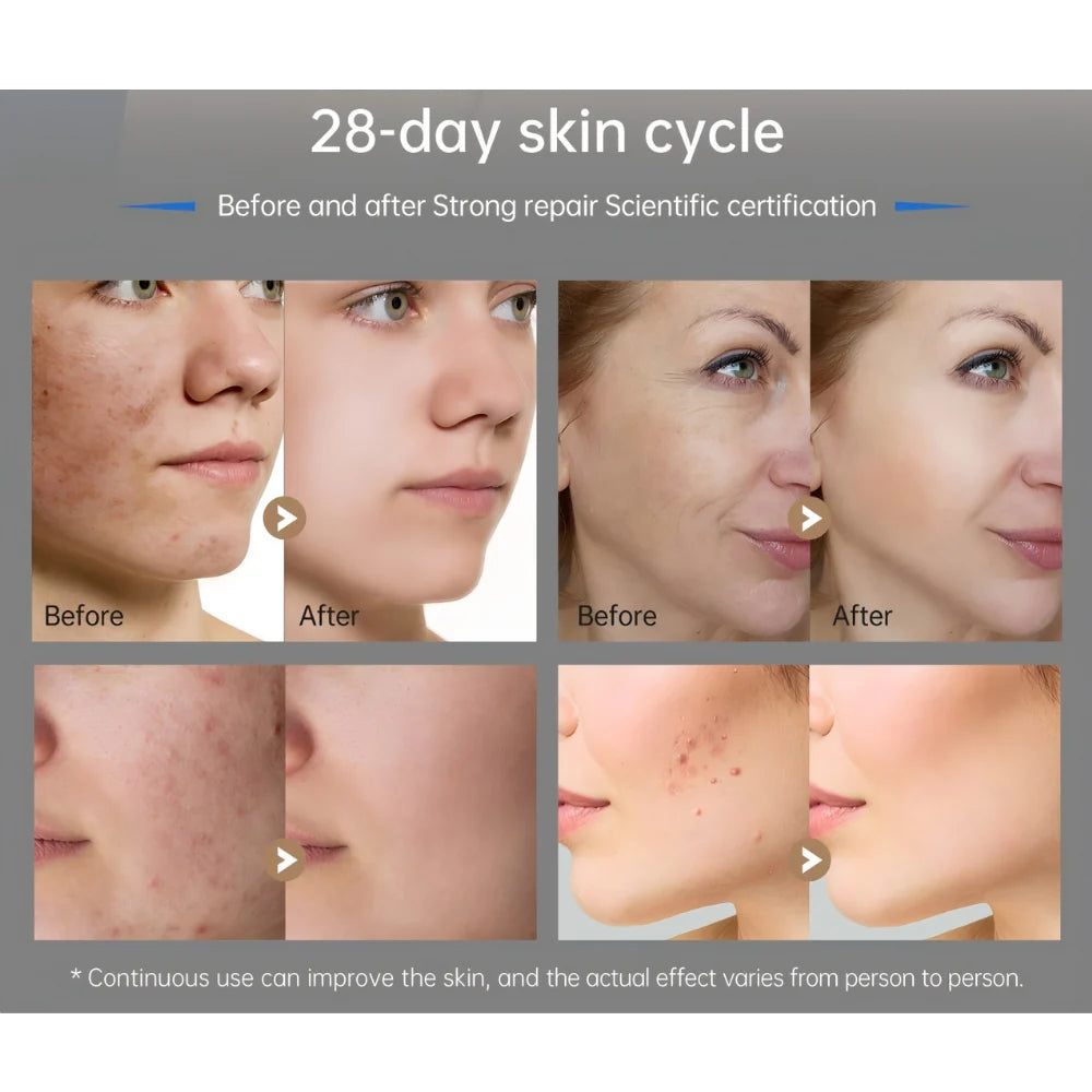 *NEW* Dr. Pen M9 Microneedling Pen